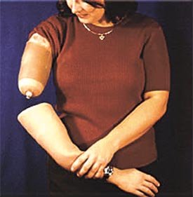 An artificial upper limb