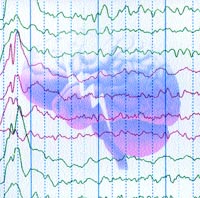 Brain superimposed on EEG graph