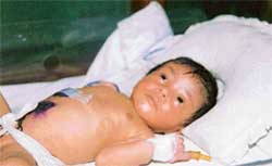 Little Kashish recuperates at Toor Hospital
