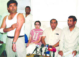 Kehav Chauhan , son of Delhi Minister Raj Kumar Chauhan, showing his injuries at a press conference held by Ch. Prem Singh, president DPCC, in the Capital on Sunday