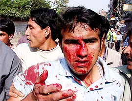 A demonstrator injured by a police missile is taken to a hospital in Kathmandu 