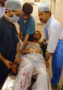 An injured man is treated by doctors at a hospital in Srinagar after 11 persons were injured on Wednesday in a grenade attack.