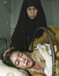 An Iraqi woman soothes her 12-year-old wounded daughter Hajer Ayid in a Baghdad hospital