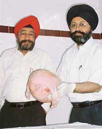 Doctors at the Nursing Home show the 7 kg tumour removed from the uterus of a patient