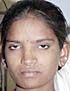 Nagmani