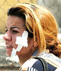 A wounded woman waits for a relative after she was hurt in a car bomb explosion outside offices of the Patriotic Union of Kurdistan 