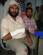 Dr K.S. Randhawa, Tehsildar-cum-Executive Magistrate, who was assaulted by members of the family of a loan defaulter at Nangli village in Amritsar district 