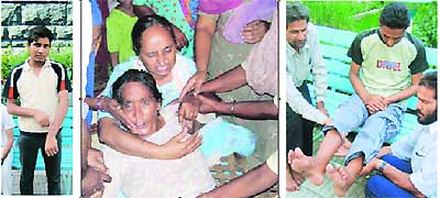 (L) A victim shows bullet injuries on his arm (C) Relatives comforting the distraught mother of a hostage.  Photo by Manoj Mahajan (R) An illegal immigrants swollen feet tell the tale of physical hardship