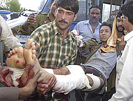 A policeman injured in a grenade blast in Pulwama being taken for treatment on Tuesday.