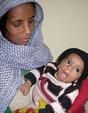 Shamima with her two-month-old son Mursleen, who has been fitted with a pacemaker at the PGI, on Wednesday.