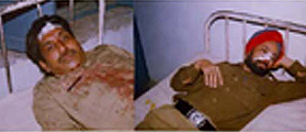 Policemen, injured after being assaulted by BKU (Ekta) activists at Ralle village in Mansa district, undergoing treatment at Civil Hospital, Joga, Mansa.