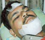 Arun Kumar, who was serious injured after his scooter was hit by the car of  Anu Chathrath,a councillor of Municipal Corporation Chandigarh.