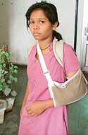 Vanita Saxena, who claims her collarbone was fractured in a clash with neighbours in Ludhiana on November 23.