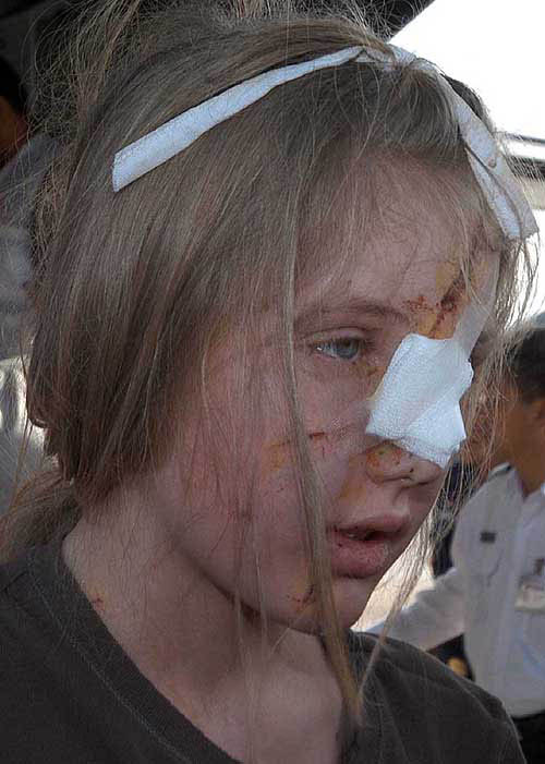 An unidentified injured person arrives at Bangkok military airport from Phuket, Thailand, on December 27.  AP/PTI