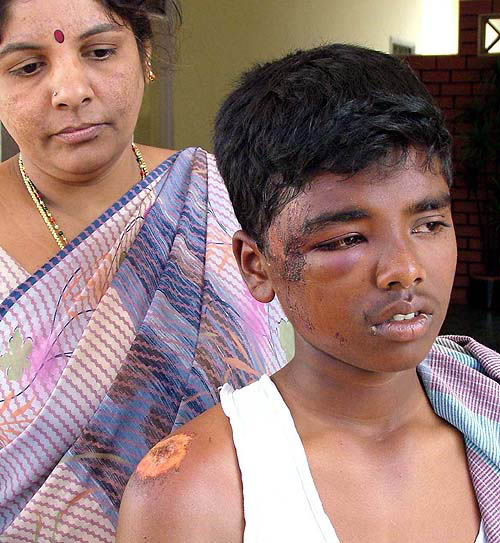 Tsunami victim Mathew, lone survivor of his nine-member family residing in Velankani, Nagapattanam of Tamil Nadu, details the devastating scene of tidal waves to the media in Bangalore on Tuesday.  PTI