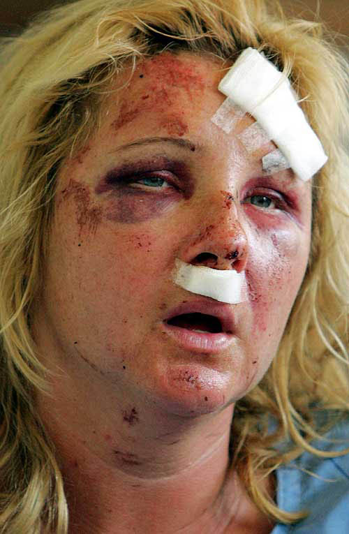 Janette Strum from Sweden weeps as her 16-year-old injured son, Matias, lies near her while they wait to be airlifted out of the Thai resort island of Phuket on December 28, 2004. Strum's 13-year-old son, Jonathan, is still missing after a quake-triggered tsunami swept into the popular tourist resort on Sunday, killing hundreds.  Reuters