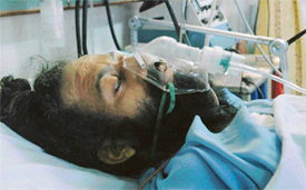 Gurbachan Singh, who suffered a gunshot injury in an armed robbery at Bhamian Kalan village on Wednesday, under treatment at CMC hospital in Ludhiana 
