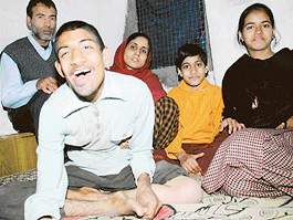 Mentally-challenged Sarfaraz looks at the camera as parents Mozahir Hassan and Noorjehan (extreme left) watch. Also seen are Hassans disabled daughters Nagma and Rubina.