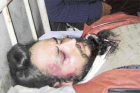 Kulwinder Singh, a shopkeeper, who was allegedly beaten up by the police, in the Rajinder Hospital in Patiala