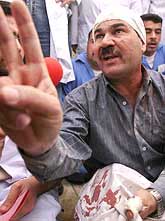 A wounded Iraqi doctor, Khalid Kaki, tells journalists how he was beaten by Iraqi Army soldiers