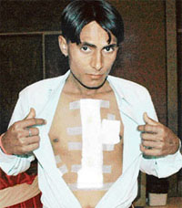 Charan Singh, a resident of Barnala, who had a life-saving surgery at a heart institute in Ludhiana
