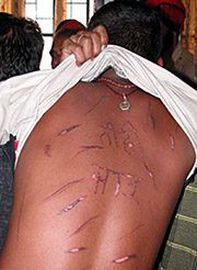 Mohan Lal shows his branded back in Ludhiana on Monday