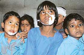 The physically challenged children, who were injured in the road accident, sit terrorised at the General Hospital waiting for their parents in Panchkula