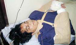 Anganwadi worker Shakuntala Verma lies unconscious after her operation at the Gokuldas Hospital in Indore, about 200 km from Bhopal, on Wednesday a day after her arms were brutally chopped off at a village in Dhar district of Madhya Pradesh. 