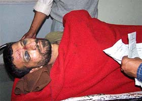 A man who was injured in a bus accident near Theog, 40 km from Shimla, receives treatment at the IGMC and Hospital in Shimla on Wednesday morning