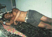 Injured factory worker under treatment in a private nursing home at Mandi Gobindgarh. 