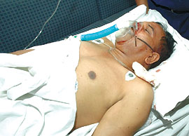 Constable Harish Chand of Ashok Vihar Police Station, who was injured by the robbers in a firing, recovering at Sunder Lal Jain Hospital on Thursday
