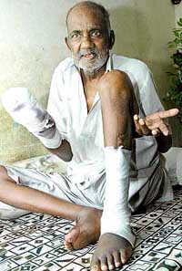 Former swing bowler Devi Chand rues his pathetic condition at his home in Sector 21 in Chandigarh