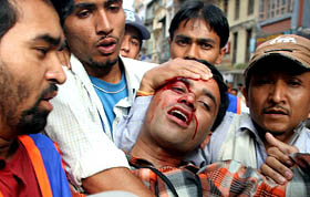 Radio journalist Tilak Mahat, injured in a police baton charge at Bagh Bazar in Kathmandu on Tuesday, is taken to hospital.  