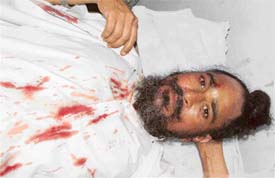 Baldev Singh who was injured in a clash on Wednesday