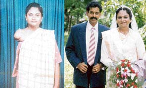 Mary TA from Kerala who came to Roshni with a dysfunctional upper limb five years ago. After correction of the limb, Mary recently got married to an able bodied man in Kerala.