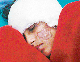 Karamjit Kaur, state fencing champion, who is hospitalised in Mohali.