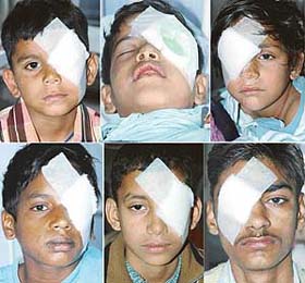 Six youngsters who were admitted to the PGI, Chandigarh, with eye injuries