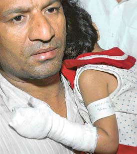 A child injured in the recent Delhi blasts: Disaster reporting calls for restraint and tact. 