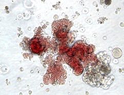 A blood cell