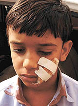 A child injured in the accident
