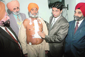 Doctors of the BBC Heart Care along with the patient on whom the rare bypass surgery was performed in Jalandhar on Monday.