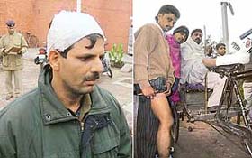 Constable Dharminder Kumar and Parvesh Kumar show their injuries in Mauli Jagran, Chandigarh