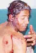 Jasbir Singh, one of the assailants