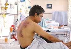 Mr Ashok Kumar Arora nursing his injuries in the Sector 16 General Hospital in Chandigarh on Thursday. 