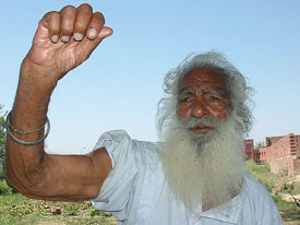 An eyewitness to the massacre of Jallianwala Bagh, Bapu Shingara Singh, shows marks of bullet wounds on his arm.