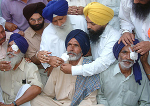 Bandages being removed from the eyes of patients at the Golden Temple complex, Amritsar, on Friday.