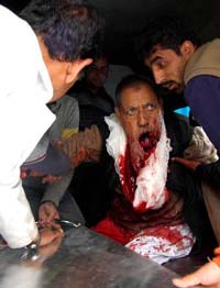 Badly injured former Speaker of Jammu and Kashmir Ali Mohammad Naik being shifted to a hospital in Srinagar on Monday. 