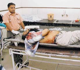 The bullet-riddled body of gangster Prabhjinder Singh Dimpy at General Hospital, Chandigarh, late on Friday night.