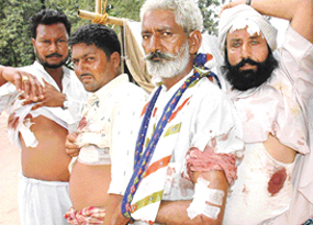 Victims show their injuries at Matka Chowk, Chandigarh, on Thursday.