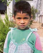 Four-year-old abandoned Kannu at the Pingalwara in Chandigarh.